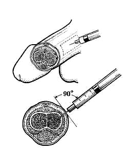 stem erectile injection dysfunction penis pge1 therapy cell into ed penile prostaglandin safe treatment cells using fig adult chong produces