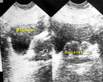 Ultrasound