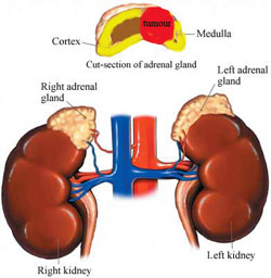 Adrenal Adrenal
