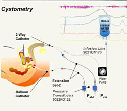 Urinary Incontinence Picture of Urinary Incontinence