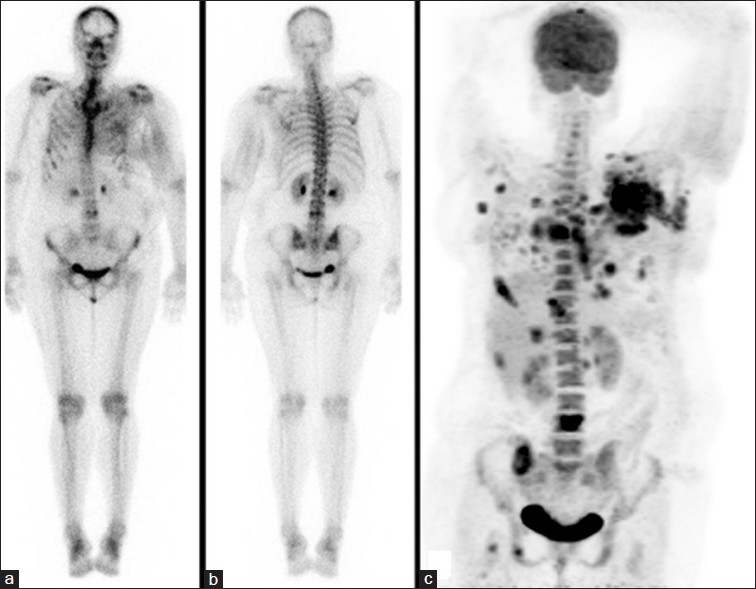 Prostate Cancer Chin Chong Min Urology & Robotic Surgery