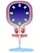 overflow incontinence icd 10